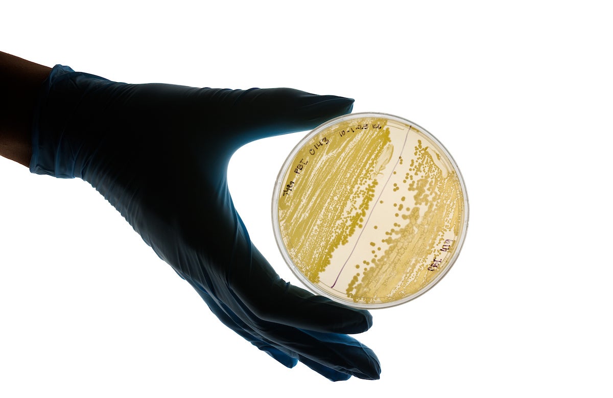 A gloved hand holds a petri dish with many bacterial cultures in it.