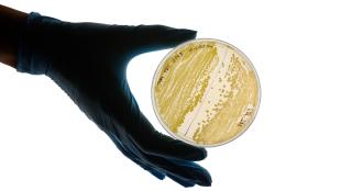 A gloved hand holds a petri dish with bacteria growth