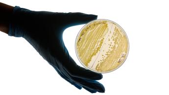 A gloved hand holds a petri dish with bacteria growth